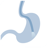 壹醫健  Dr.One 胃鏡檢查