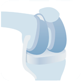 壹醫健  Dr.One 全膝關節置換手術