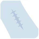 壹醫健  Dr.One 疤痕/疤痕增生